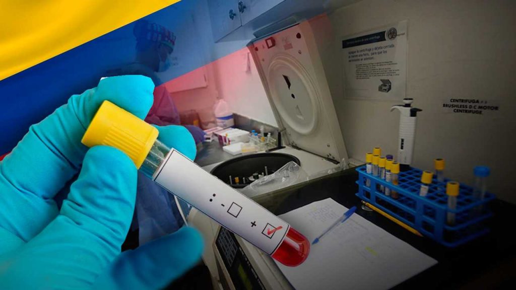 falso de epidemia de VIH